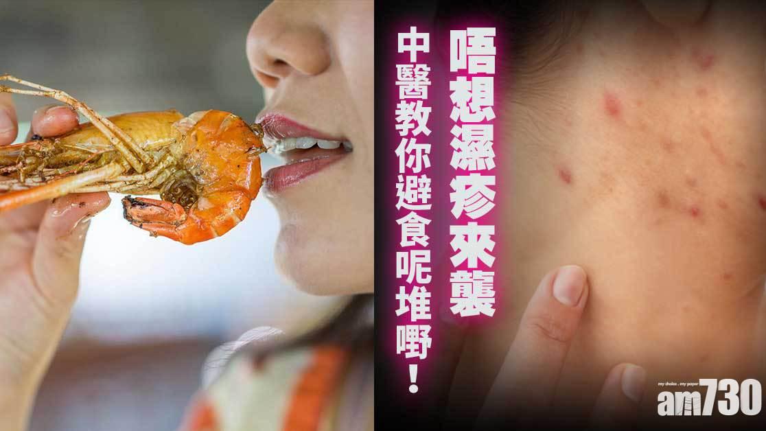 濕疹戒口食物｜壽司甲殼類海鮮等4種或引致皮膚痕癢 水果份量要小心（am730製圖）