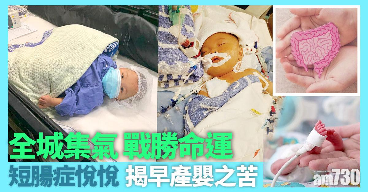 短腸症悅悅丨原來早產嬰患壞死性腸炎 致命可達四成