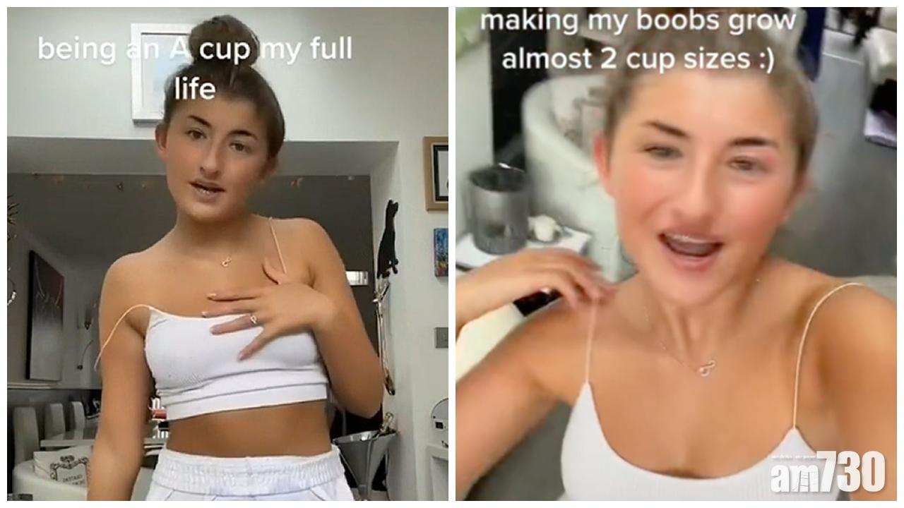 網上熱話｜平胸女：打完新冠疫苗升Cup　醫生：無科學根據