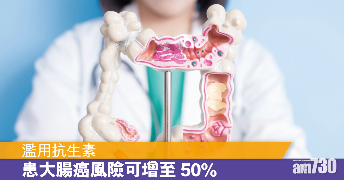 濫用抗生素 增患大腸癌