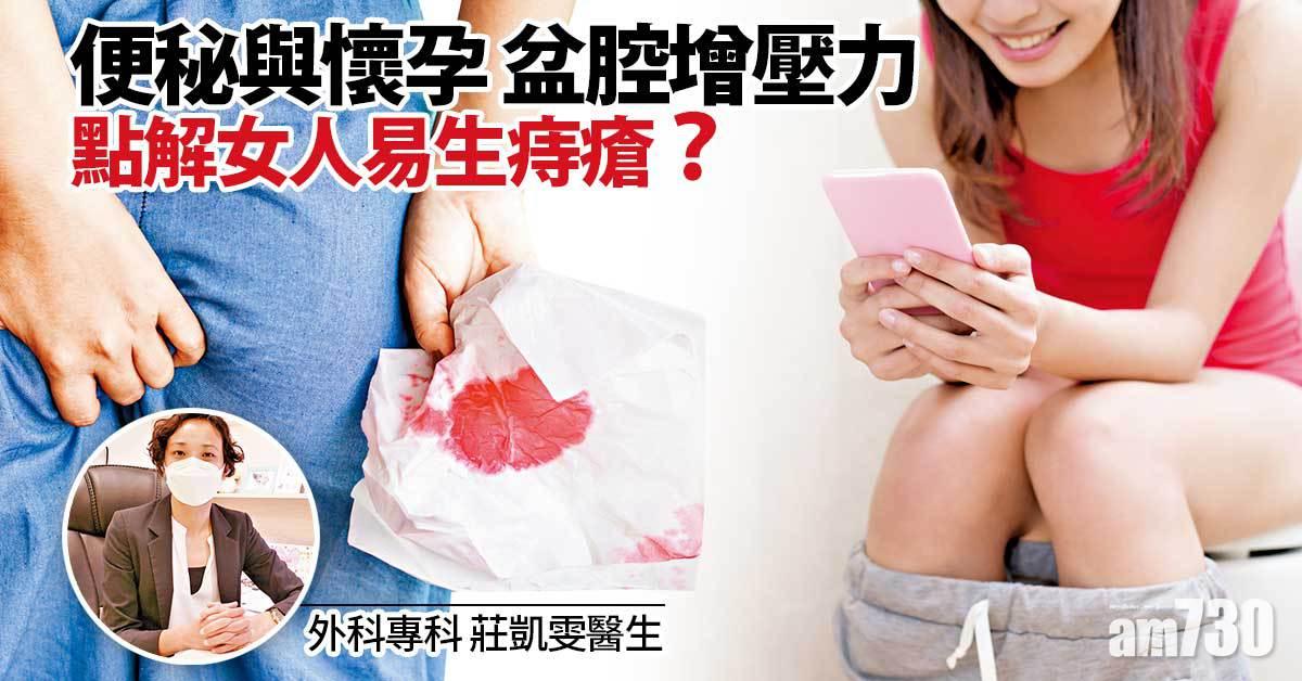 女性便秘懷孕可致痔瘡