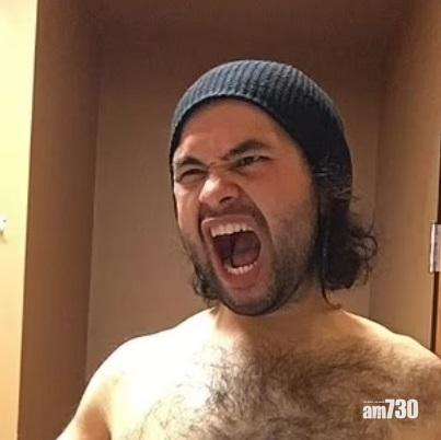 自信好緊要｜一年甩203磅肥肉變「沙皮」  28歲男唔介意反覺Cool