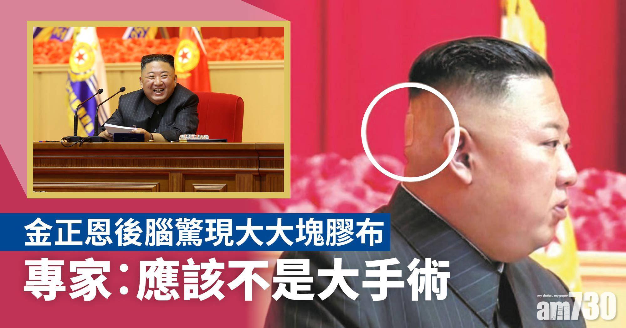 金正恩｜金仔後腦驚現大塊神秘膠布  專家︰佢切咗啲嘢