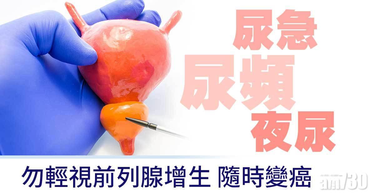 前列腺｜年紀大機器壞？及早正視問題勿諱疾忌醫
