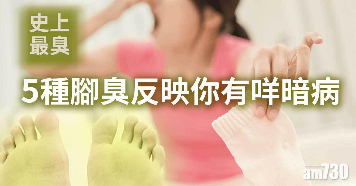 腳臭丨腳汗多 5種臭味反映隱疾 懶理何止香港腳 