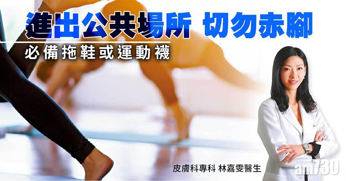 皮膚疣｜做瑜伽往泳池勿赤腳 預防生疣