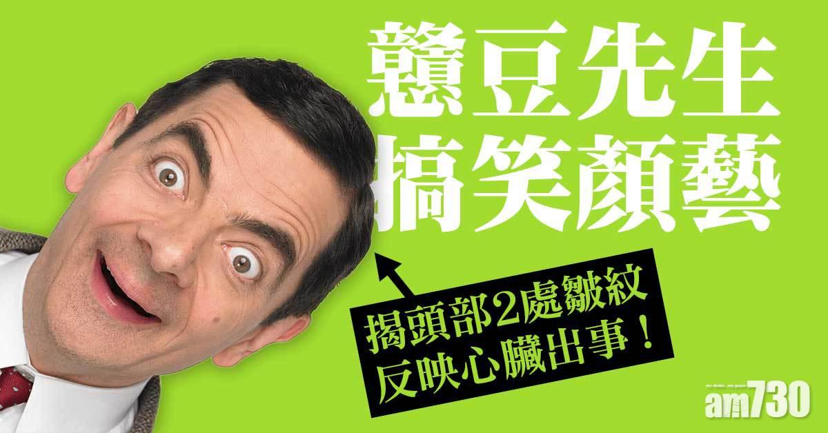 皺紋丨頭部兩處地方出現皺紋 或跟心血管病有關