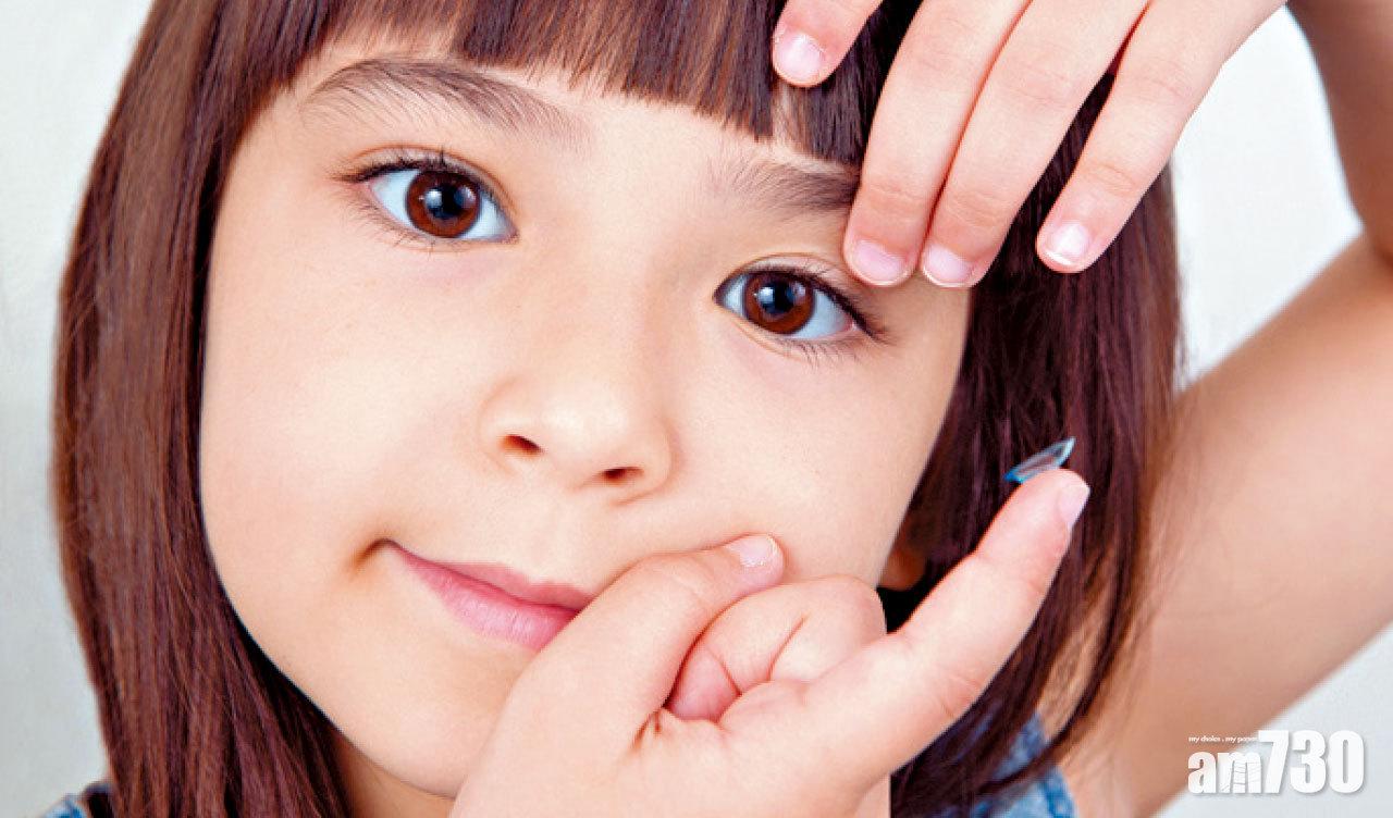夜間佩戴OK鏡 EyeCare矯正近視散光 減慢加深速度？OK！