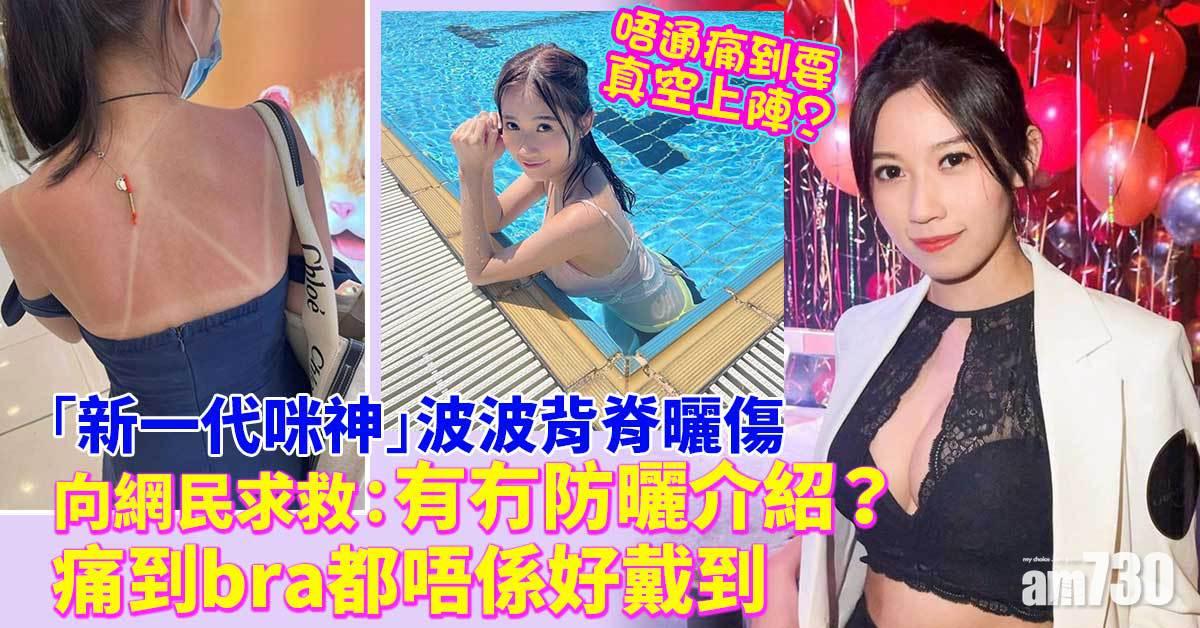 被曾志偉力讚 ｜「新一代咪神」36E波波背脊曬傷  痛到戴唔到bra