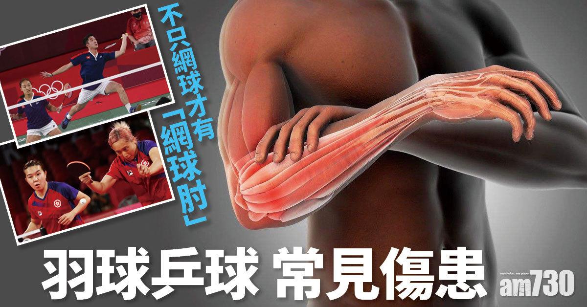 網球肘丨全民運動 認識羽毛球與乒乓球常見傷患