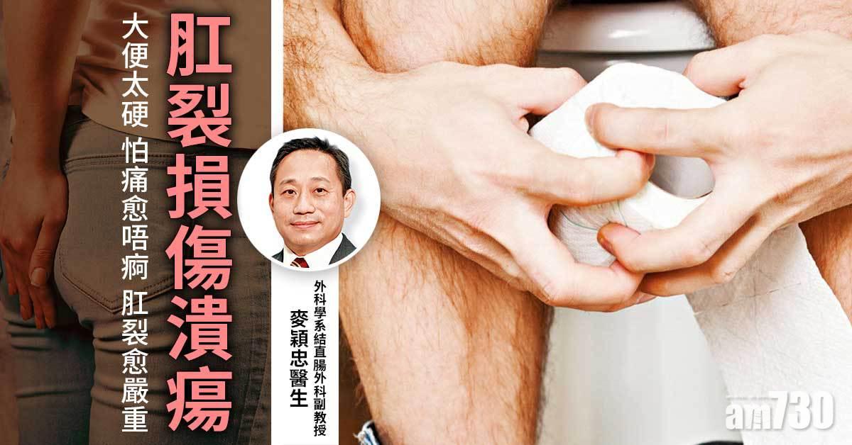 大便乾硬 隨時肛裂