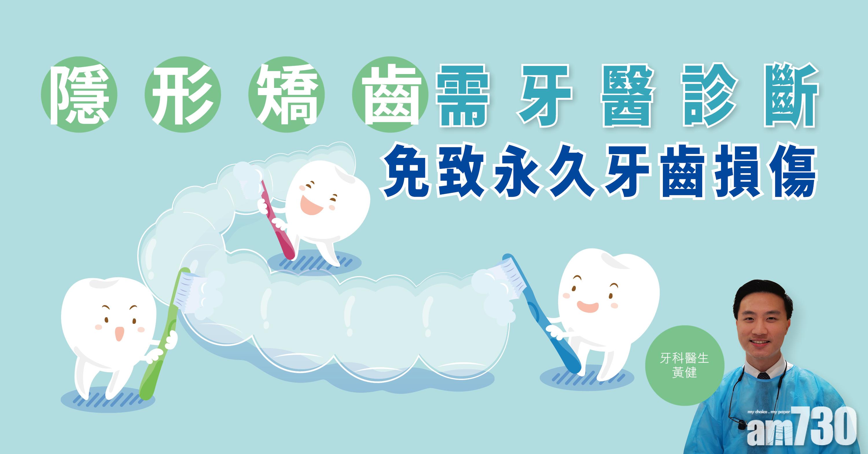 【健康解碼】隱形矯齒需牙醫診斷 免致永久牙齒損傷