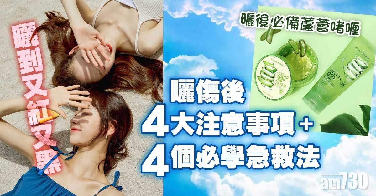 夏日防曬｜曬到又紅又黑？！曬傷後4大注意事項+4個必學急救法