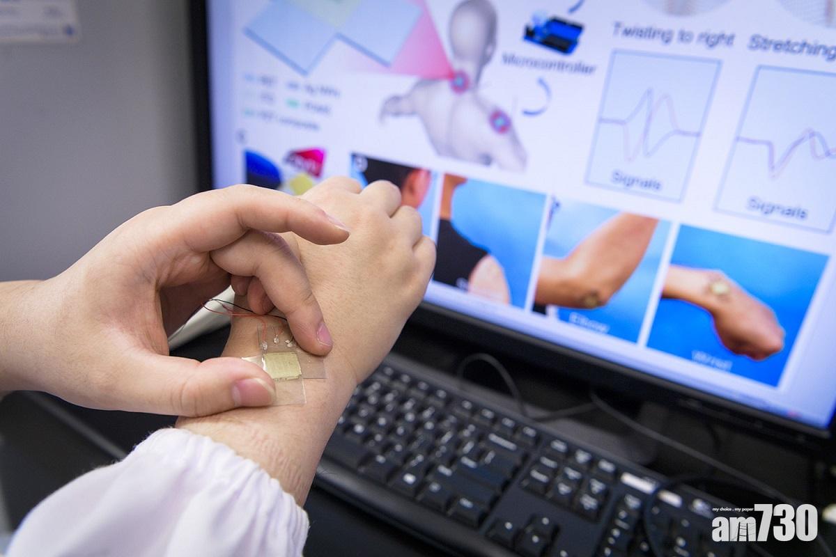 城大研發新型傳感器 監測關節運動減患關節炎