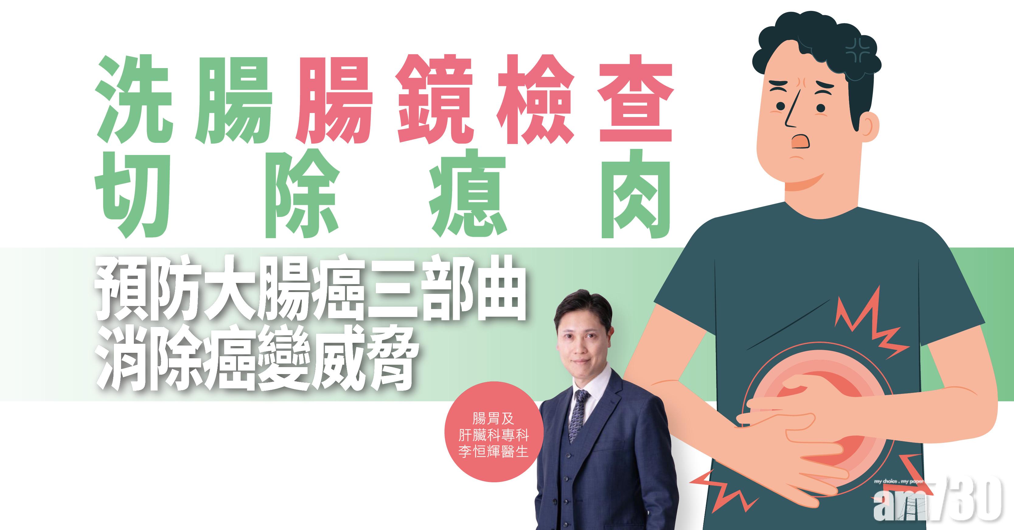 【健康解碼】洗腸腸鏡檢查切除瘜肉 預防大腸癌三部曲 消除癌變威脅