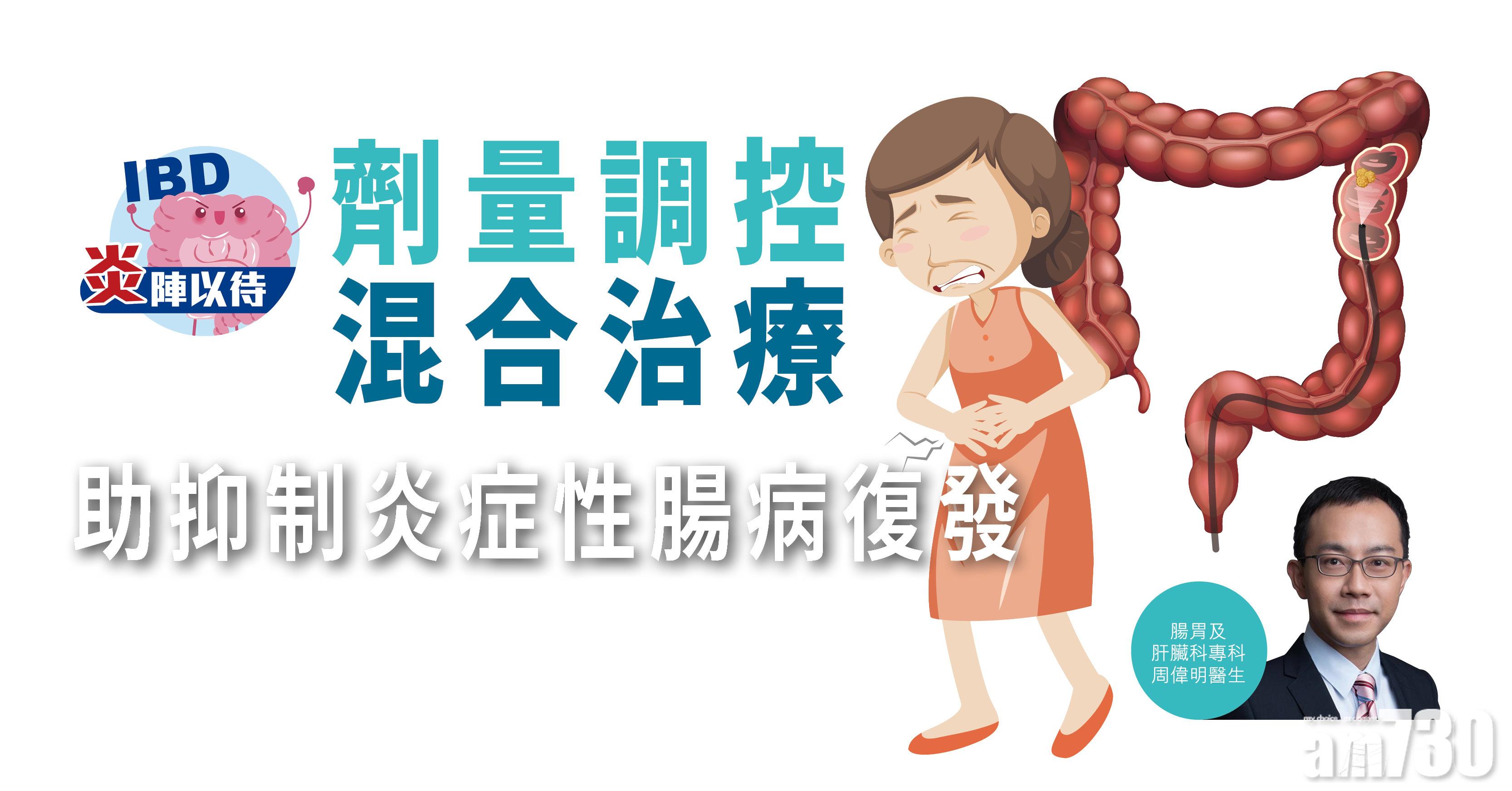 【炎陣以待】劑量調控混合治療  助抑制炎症性腸病復發