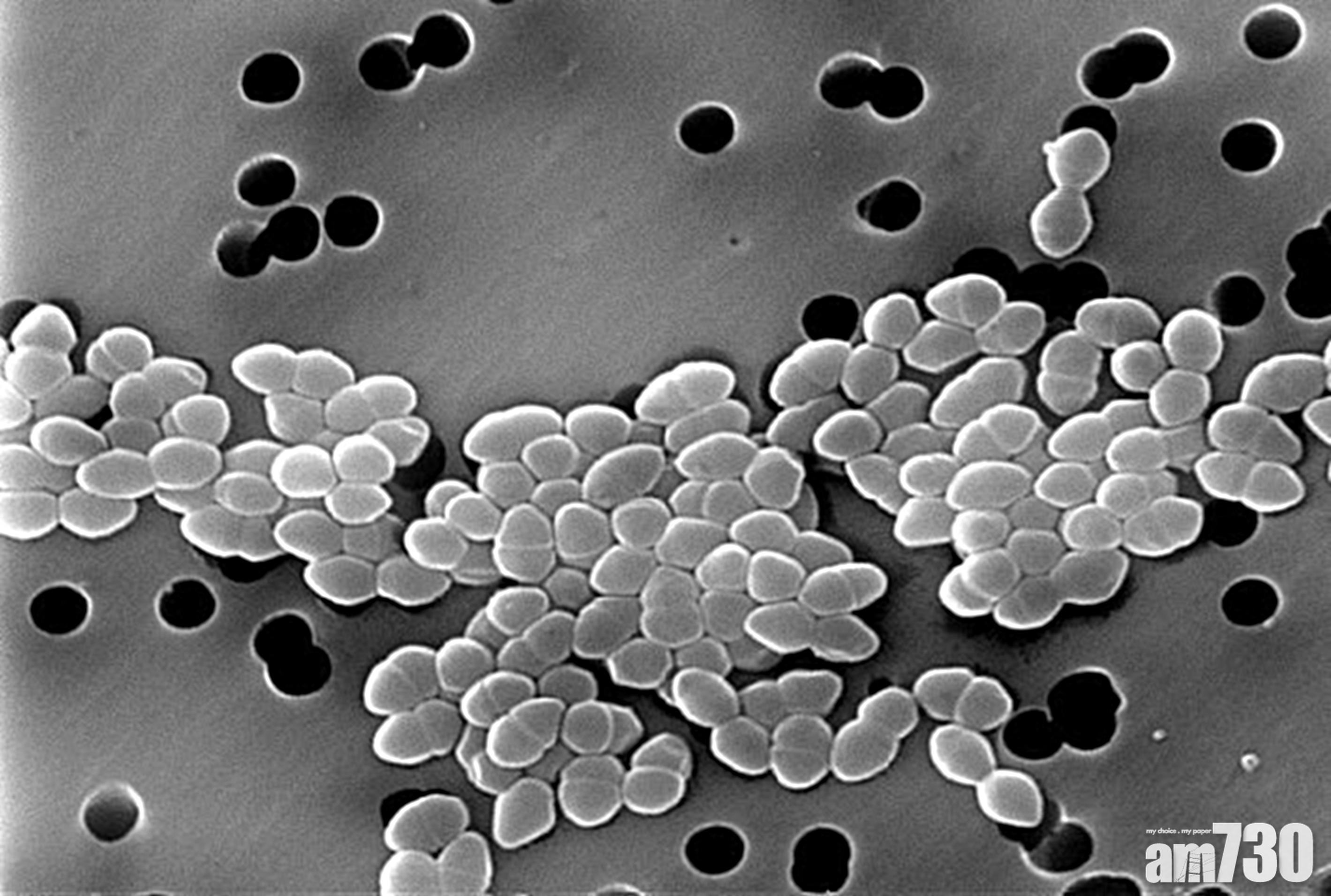 VRE｜中招好難醫 抗萬古霉素腸道鏈球菌係乜？