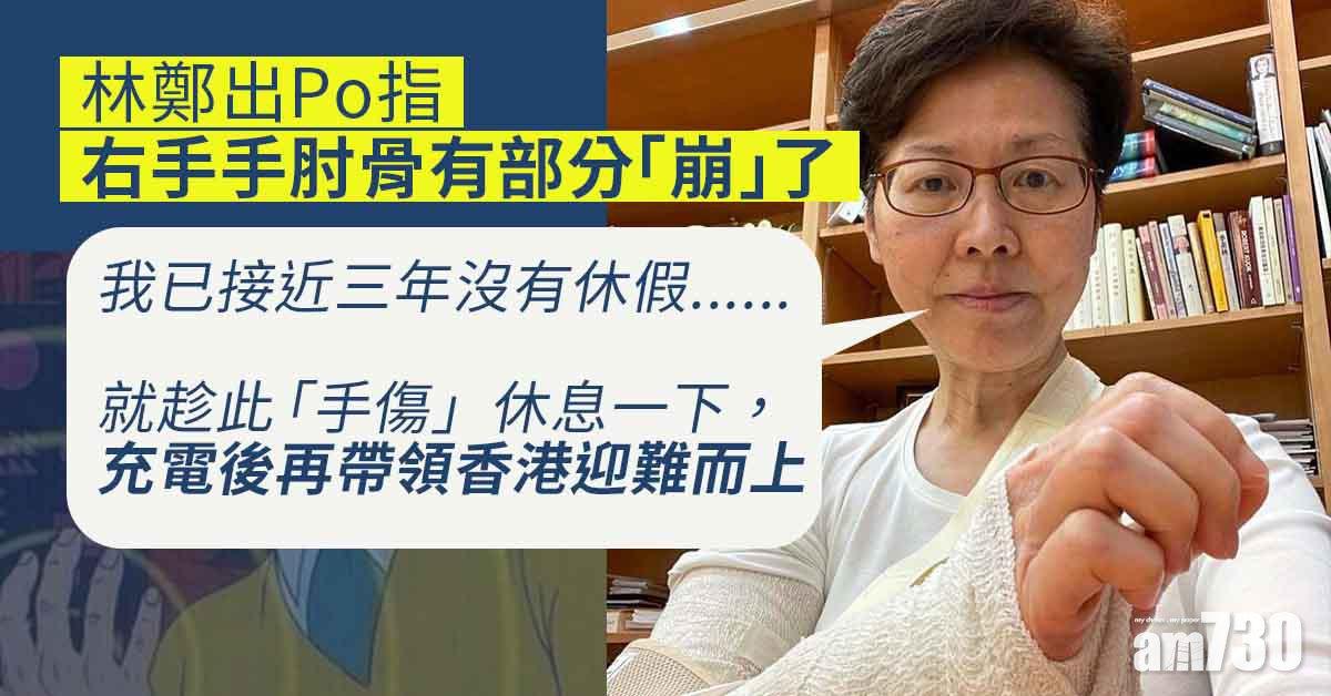 林鄭骨折｜FB報平安：右手手肘骨「崩」了　稱最大難題是穿衣寫字