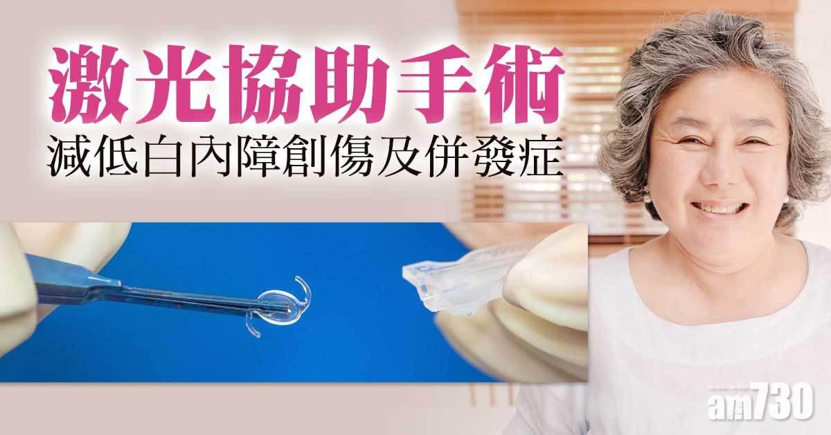 白內障｜激光協助手術 減創傷及併發症
