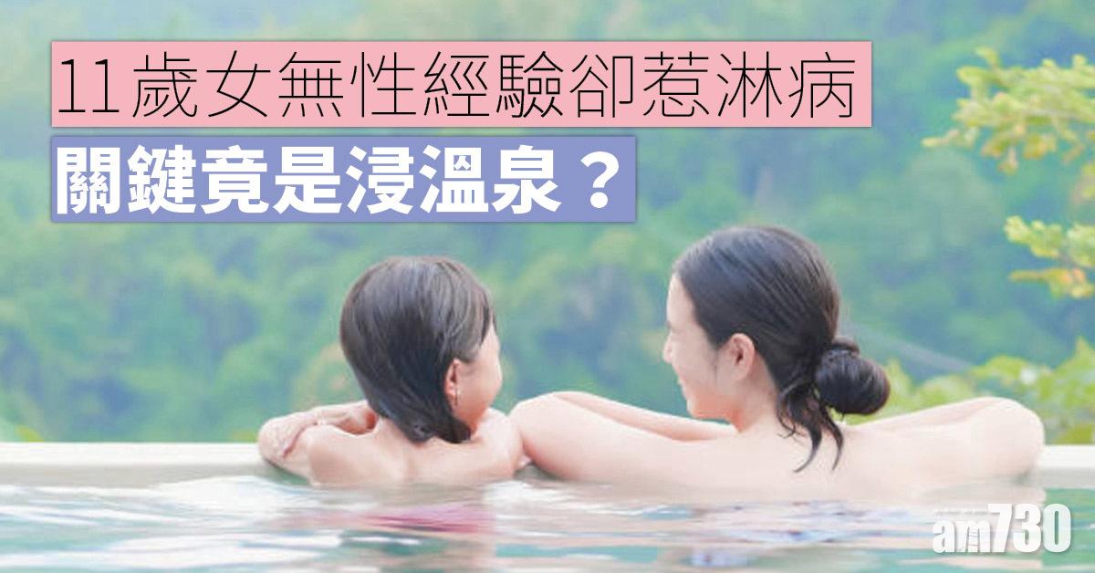 11歲女童無性經驗但染淋病 竟然關浸溫泉事？