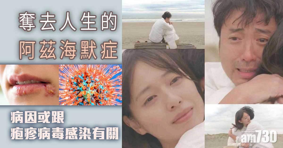 阿茲海默症丨疱疹病毒長期入侵大腦 或是癡呆與失智元兇