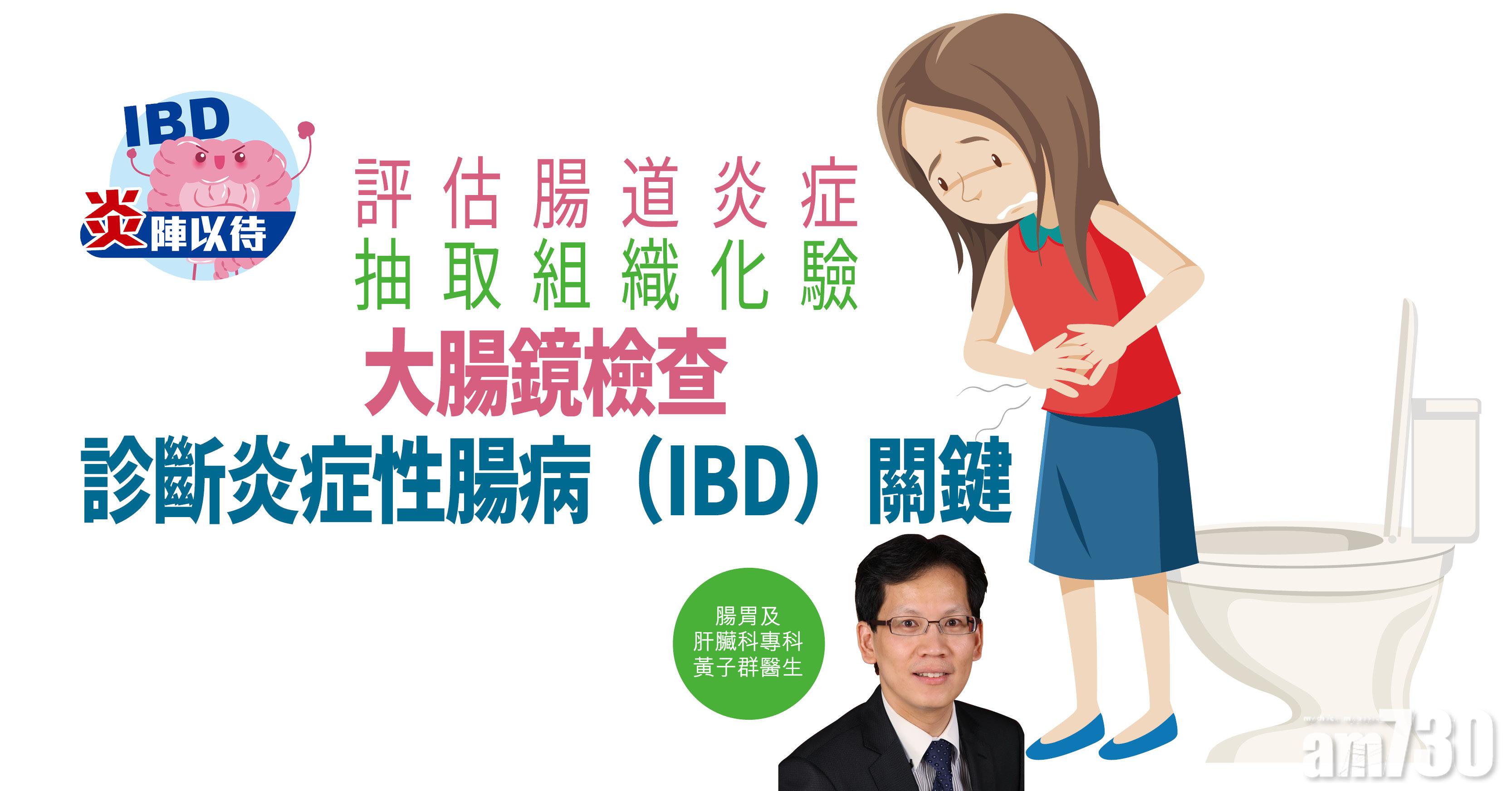 【炎陣以待】評估腸道炎症 抽取組織化驗 大腸鏡檢查 診斷炎症性腸病（IBD）關鍵