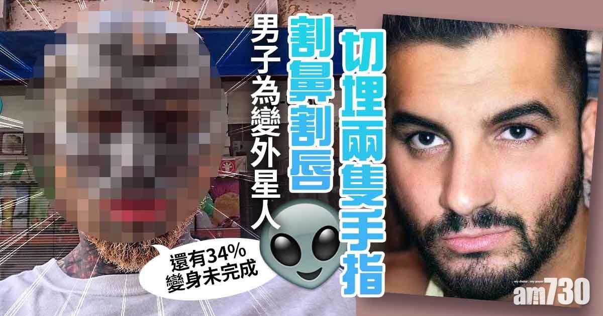 誓要變「外星人」 男子割鼻割唇切埋兩隻手指變爪