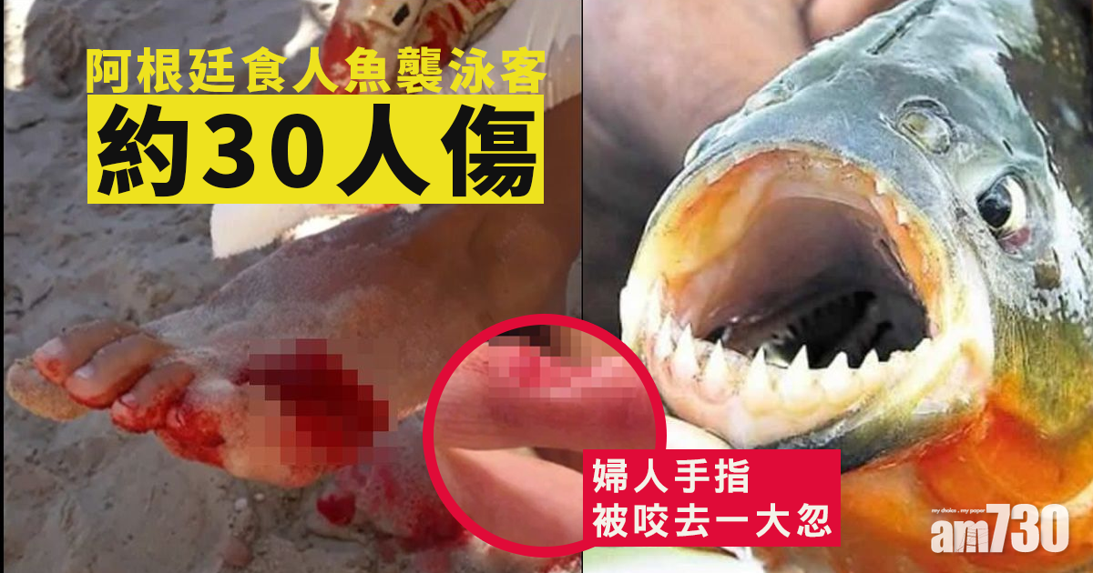 阿根廷食人魚襲泳客約30人傷  婦人手指被咬去一大忽