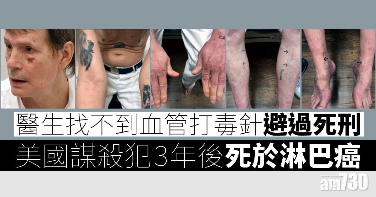 醫生找不到血管打毒針避過行刑  美謀殺犯3年後死於淋巴癌