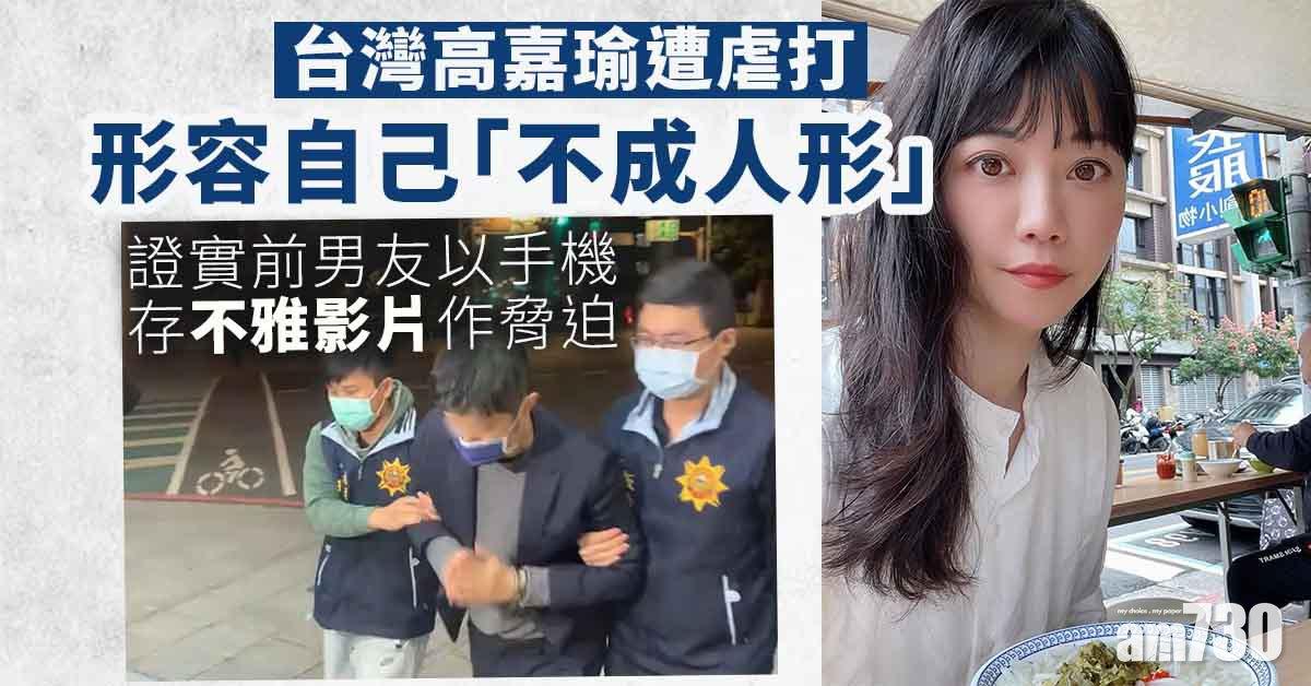 台灣立委高嘉瑜指控遭男友虐打  感丟臉無第一時間報警 