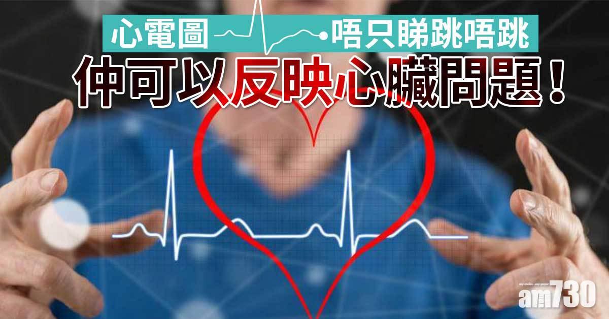 心電圖｜唔只睇跳唔跳 仲可以反映心臟問題