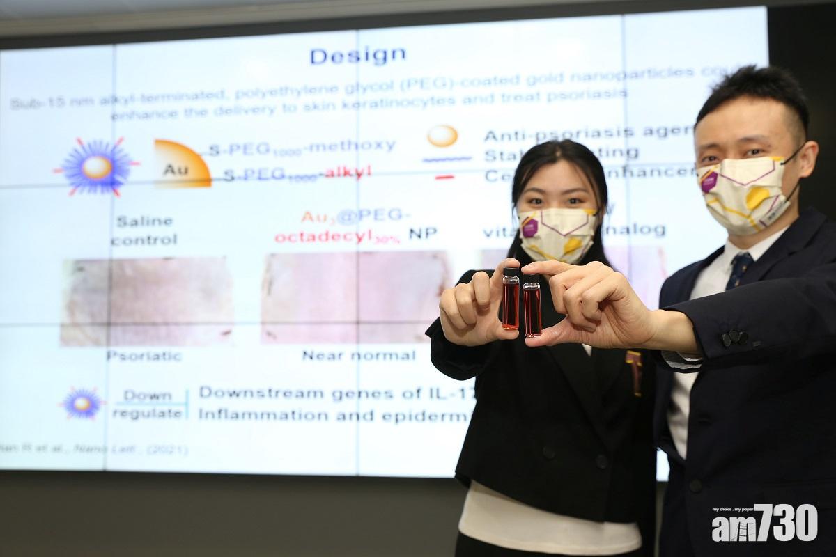 中大研究：金納米顆粒 可治銀屑病