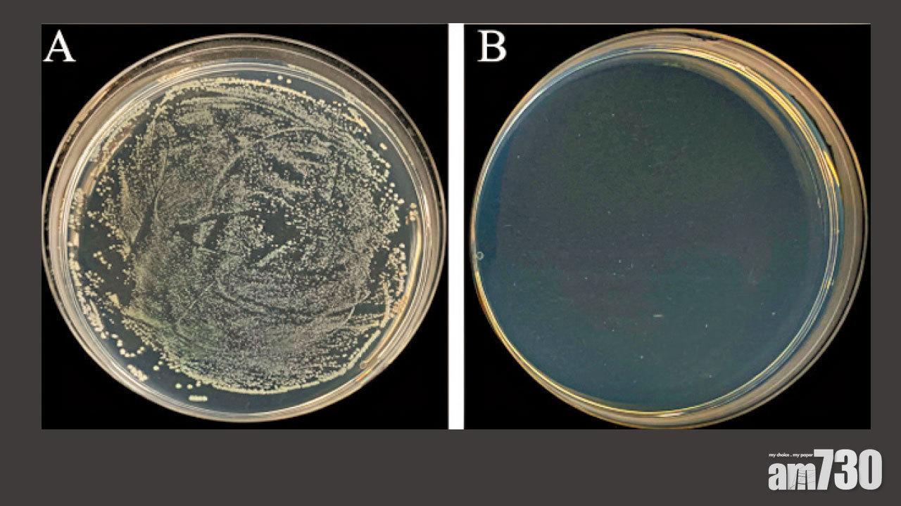抗疫技術｜港大研高銅含量不銹鋼 3小時殺滅99.97%新冠病毒