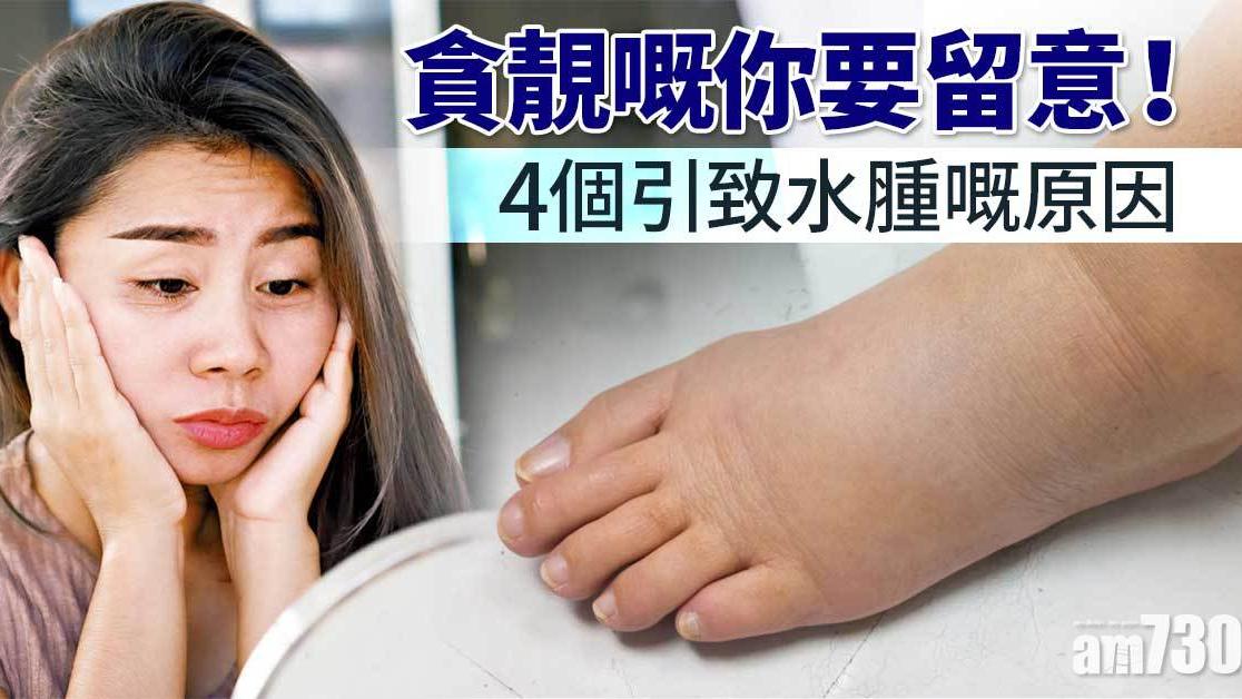 腳水腫原因｜荷爾蒙/飲水不足等4個女士常見現象。（am730製圖）