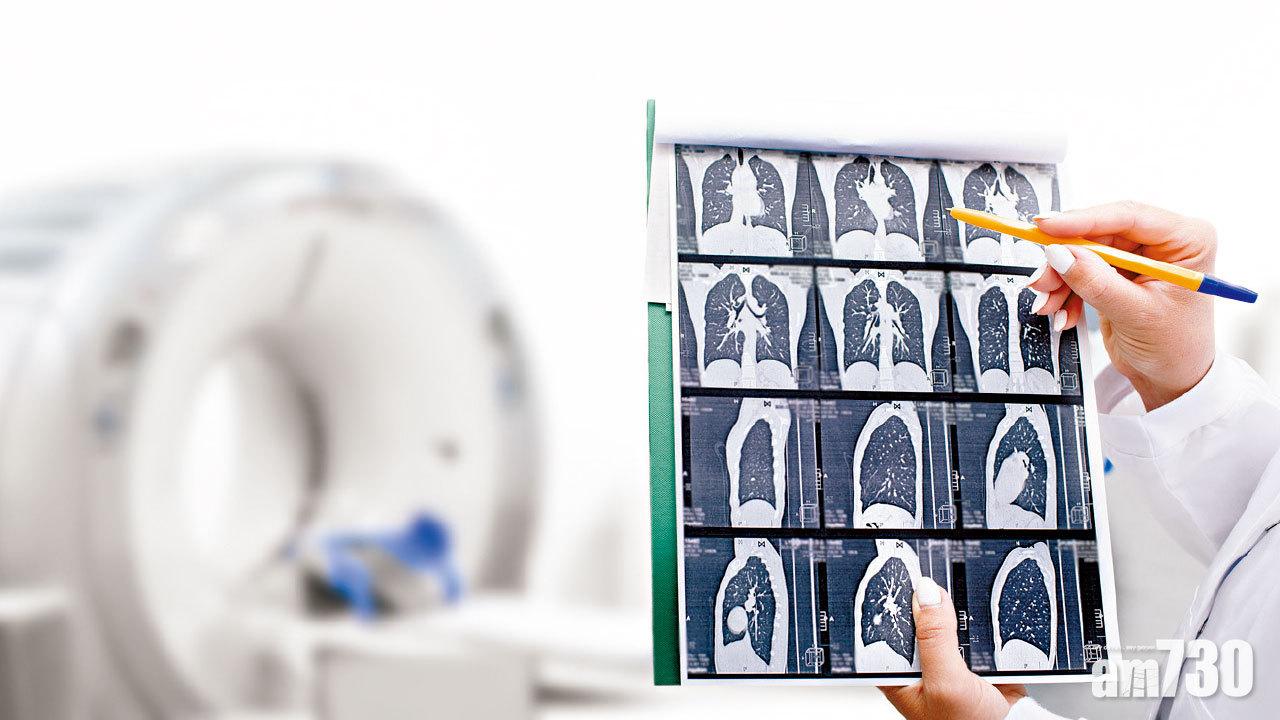 疫情新常態 仍需定期癌症篩查