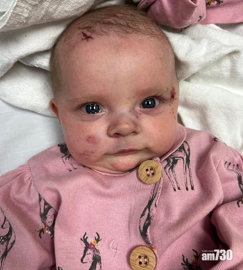 美國龍捲風災｜兩個月大女嬰不治  與父母躲浴室遭捲飛對街鄰居家