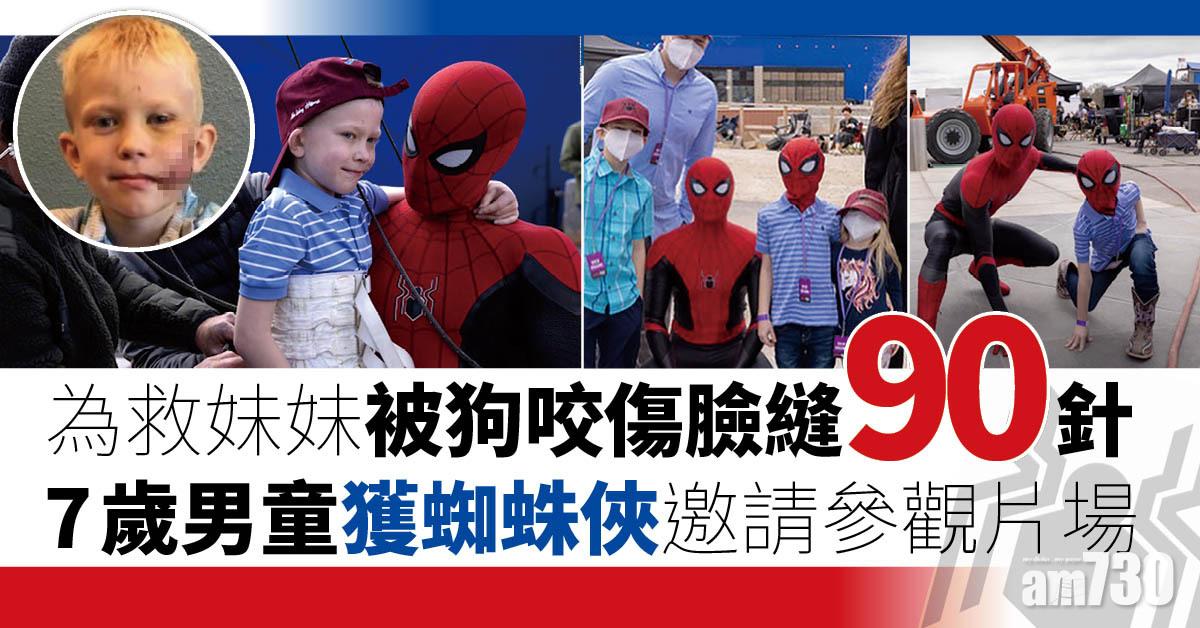蜘蛛俠不戰無歸｜救妹被狗咬傷臉縫90針  美7歲童獲蜘蛛俠邀請參觀片場(有片)