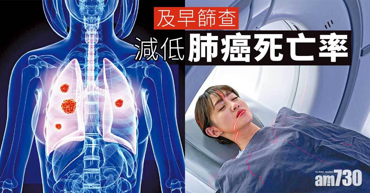 及早篩查 減肺癌死亡率
