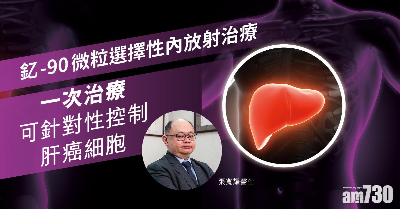 釔-90微粒選擇性內放射治療 一次治療可針對性控制肝癌細胞 
