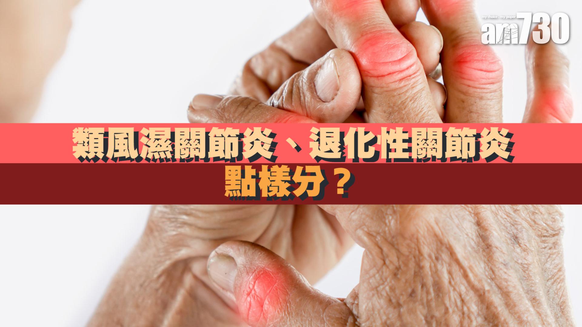 類風濕關節炎、退化性關節炎 點樣分？