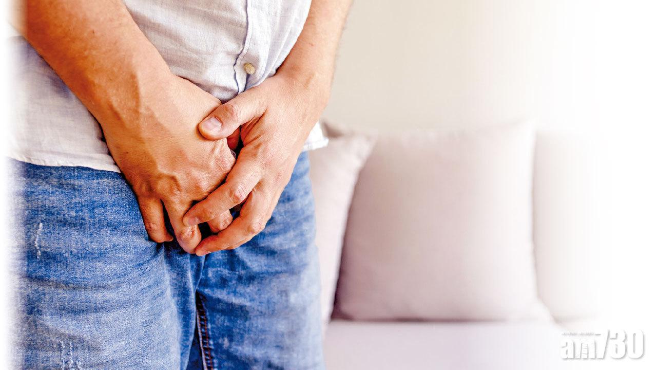 前列腺癌 水凝膠輔助治療減後遺症