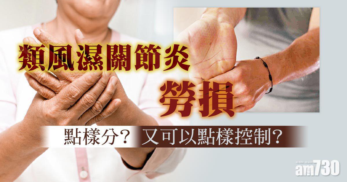 類風濕關節炎 勞損  點樣分？