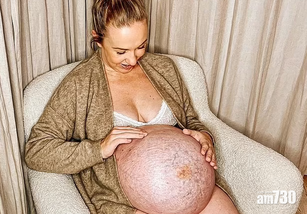 丹麥網紅懷胞胎騷巨肚嚇驚粉絲 稱腹部伸長「超痛」