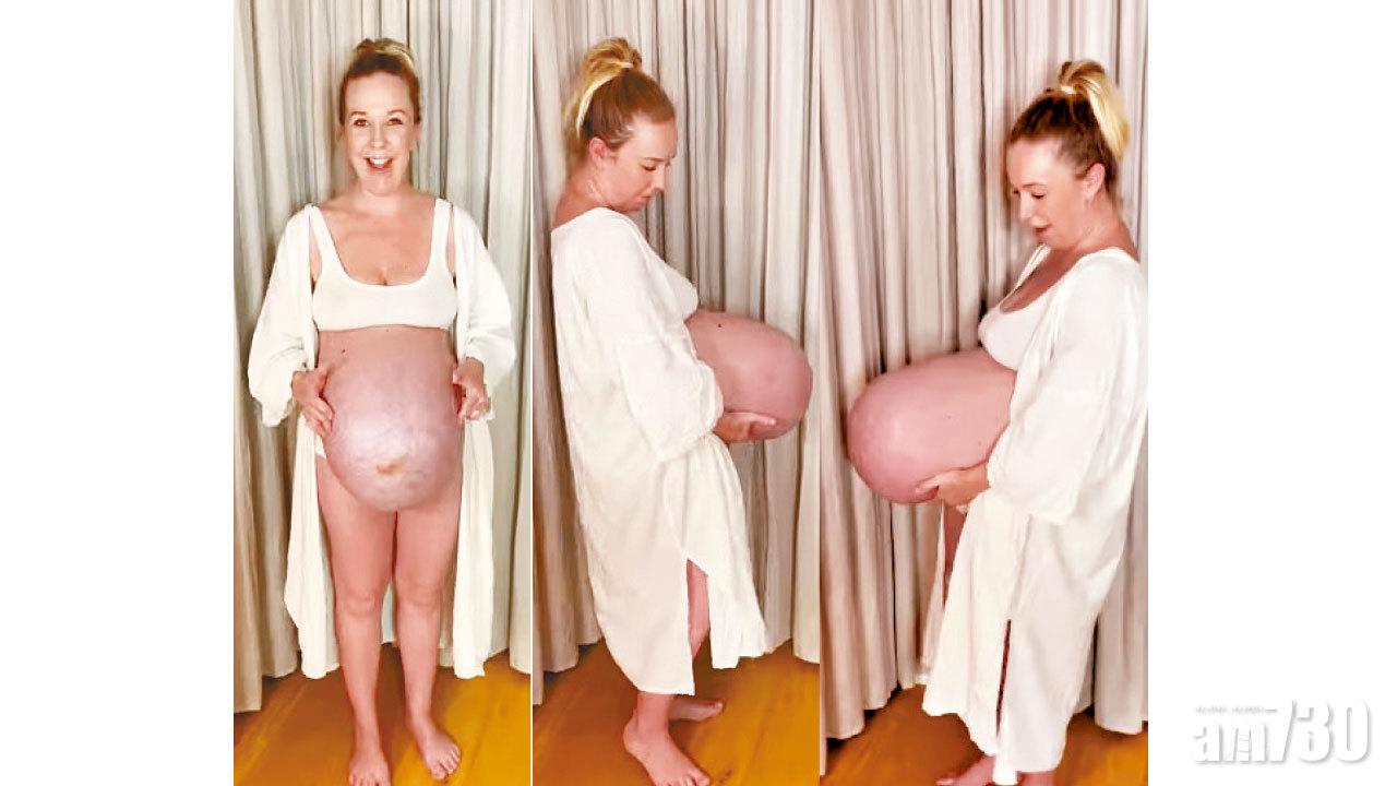 三胞胎巨肚向前凸 激似大冬瓜 
