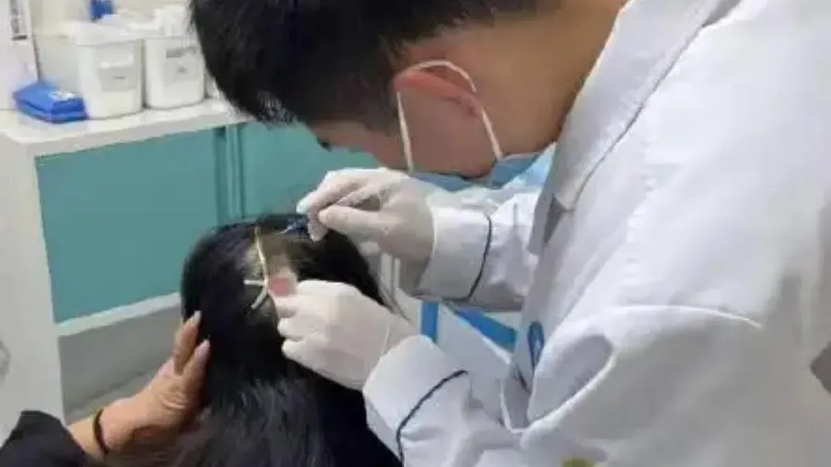 內地人妻被車撞倒　金屬鯊魚夾插進後腦險死